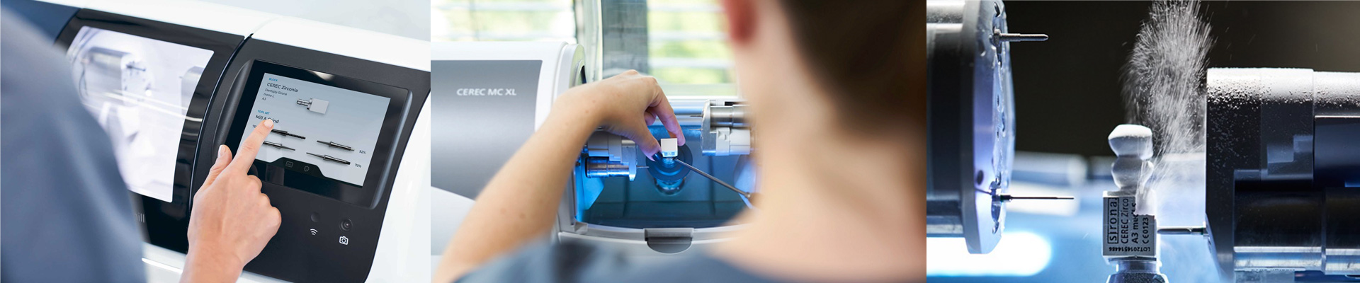 Cerec Zahnersatz